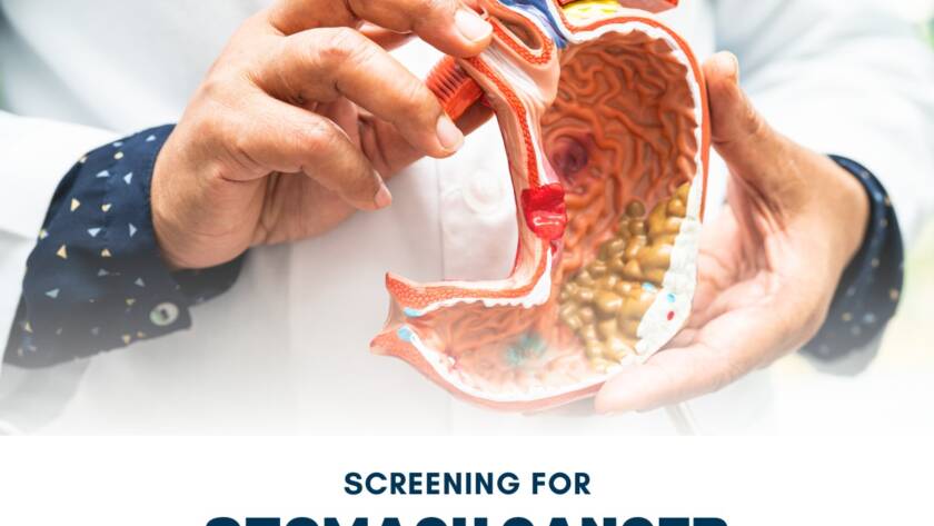 Screening For Stomach Cancer